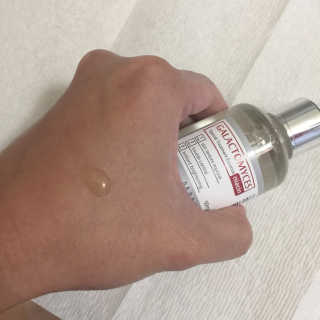 [마녀 공장] 발가락 토미 니아신 에센스 50ml — 4점을 준 리뷰어가 2018년 11월 올린 사용 사진