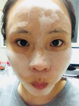 셀퓨전씨 트리악 포어 딜리트 버블 팩 — 5점을 준 리뷰어가 2018년 4월 올린 사용 사진