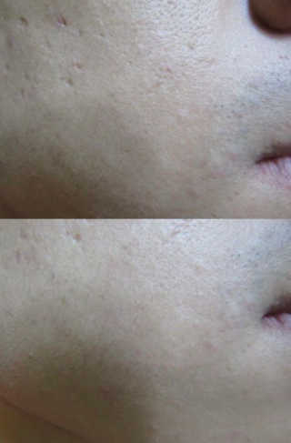 임줴님이 올린 리뷰 사진 1