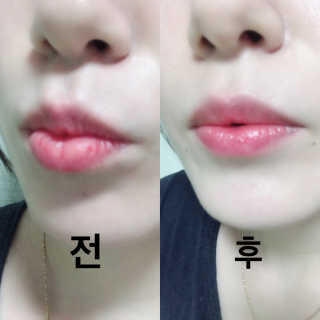 블리스텍스 립 릴리프 크림 립밤, 립 바이브런스 립밤 — 3.67점을 준 리뷰어가 2018년 11월 올린 사용 사진