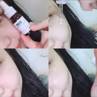 어니시 닥터에이 99앰플 세트 10ml X 5개 — 5점을 준 리뷰어가 2019년 4월 올린 사용 사진
