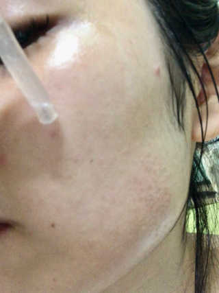 아이소이 파란소화기 응급스팟 — 5점을 준 리뷰어가 2018년 3월 올린 사용 사진