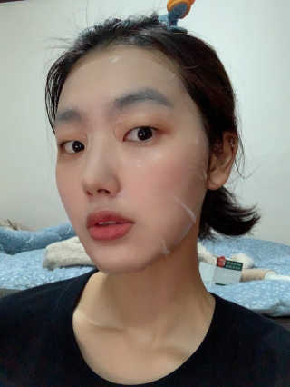 로벡틴 닥터 마스크 시카 — 5점을 준 리뷰어가 2019년 12월 올린 사용 사진