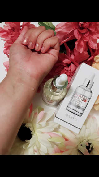 [마녀 공장] 발가락 토미 니아신 에센스 50ml — 4.83점을 준 리뷰어가 2018년 11월 올린 사용 사진