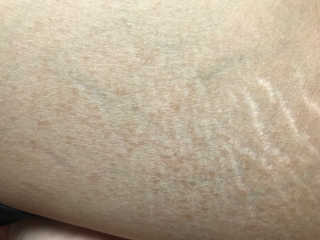 ddu님이 올린 리뷰 사진 2