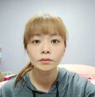 아이디플라코스메틱 아이디 페이스핏 마이너스 밴드 — 5점을 준 리뷰어가 2020년 3월 올린 사용 사진