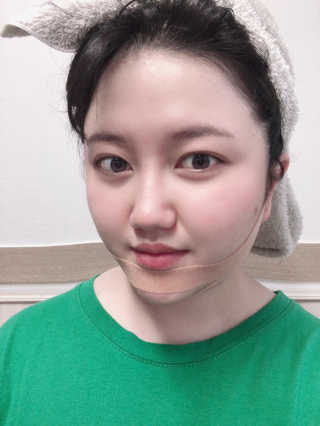 아이디플라코스메틱 아이디 페이스핏 마이너스 밴드 — 4점을 준 리뷰어가 2020년 4월 올린 사용 사진