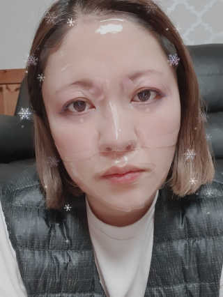 어셀리 브릴리언스 솔루션 하이드로겔 페이셜 마스크 — 5점을 준 리뷰어가 2020년 1월 올린 사용 사진