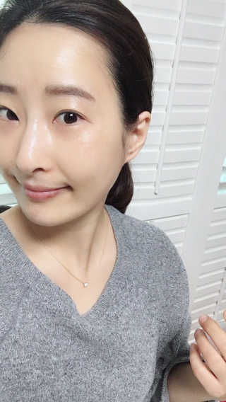 [더마허브] 주사팩 5종, 물광,백옥,태반,신데렐라 등 — 5점을 준 리뷰어가 2018년 3월 올린 사용 사진