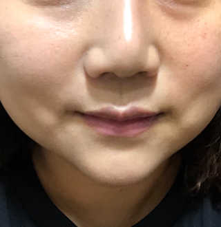레미님이 올린 리뷰 사진 4
