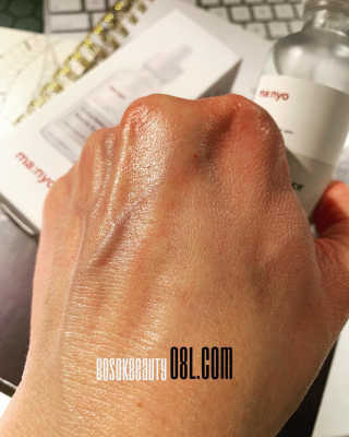 [마녀 공장] 발가락 토미 니아신 에센스 50ml — 5점을 준 리뷰어가 2019년 4월 올린 사용 사진