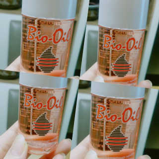 Bio-oil(바이오오일) 바이오오일 — 4.5점을 준 리뷰어가 2016년 10월 올린 사용 사진