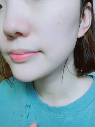 아크웰 아크네 클리어링 딥 클렌징 폼 — 3.5점을 준 리뷰어가 2019년 3월 올린 사용 사진