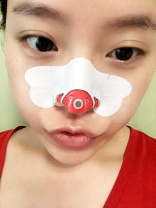 나이팅게일 TAKO PACK NOSE [문어코팩] — 4점을 준 리뷰어가 2017년 5월 올린 사용 사진