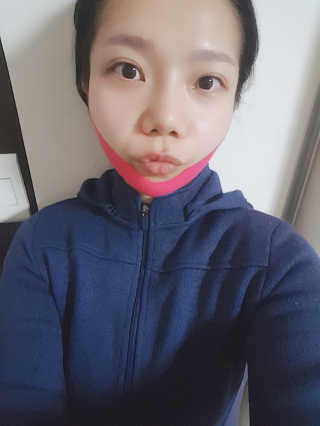 스케덤 펩타이드 리프팅밴드 — 4.5점을 준 리뷰어가 2019년 3월 올린 사용 사진