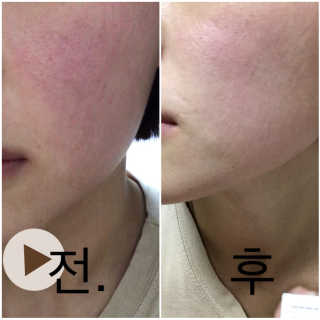 skslrk님이 올린 리뷰 사진 1