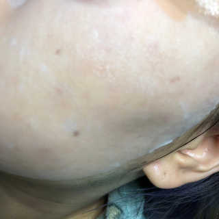 로벡틴 닥터 마스크 시카 — 5점을 준 리뷰어가 2020년 1월 올린 사용 사진