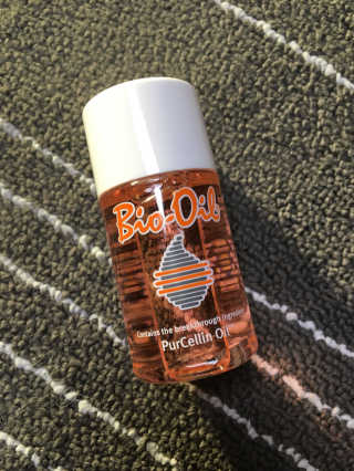 Bio-oil(바이오오일) 바이오오일(Bio-oil) — 5점을 준 리뷰어가 2017년 2월 올린 사용 사진