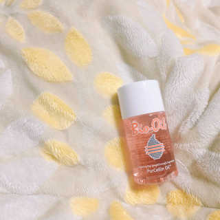 Bio-oil(바이오오일) 바이오오일(Bio-oil) — 5점을 준 리뷰어가 2016년 12월 올린 사용 사진