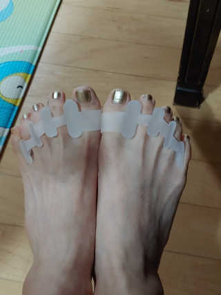 힐링팩토리 밸런스 발가락링 발가락교정기 A1 — 1점을 준 리뷰어가 2019년 12월 올린 사용 사진