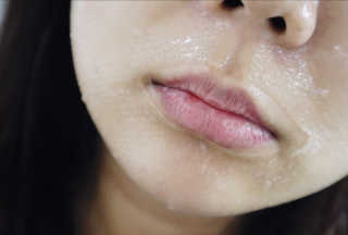 메디타임 멜라반 더마 토닝 씬젤 — 5점을 준 리뷰어가 2019년 6월 올린 사용 사진