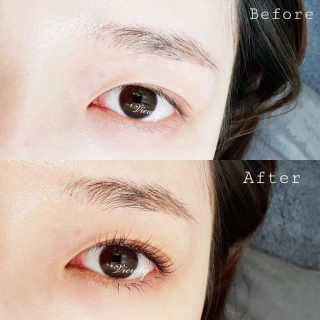 Viewty Skin and Lash [ViewtySkin＆Lash] 종아리 림프순환 부종관리 — 5점을 준 리뷰어가 2019년 3월 올린 사용 사진