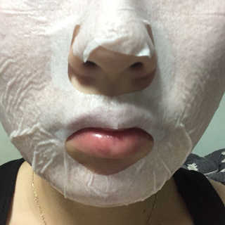 23years old 바데카실 더마실 마스크 — 5점을 준 리뷰어가 2018년 5월 올린 사용 사진