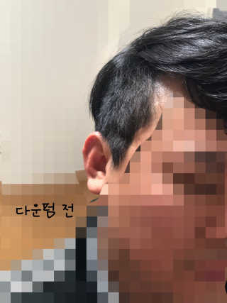 다슈코리아 다슈 포 맨 프리미엄 울트라 본드 젤 다운펌 — 4.5점을 준 리뷰어가 2018년 11월 올린 사용 사진