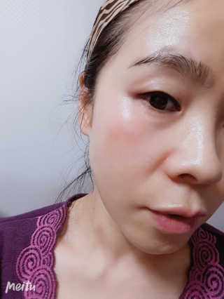 로벡틴 닥터 마스크 아쿠아 — 5점을 준 리뷰어가 2019년 12월 올린 사용 사진