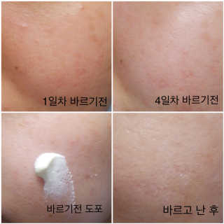 23years old 징크놀 — 4.5점을 준 리뷰어가 2017년 3월 올린 사용 사진