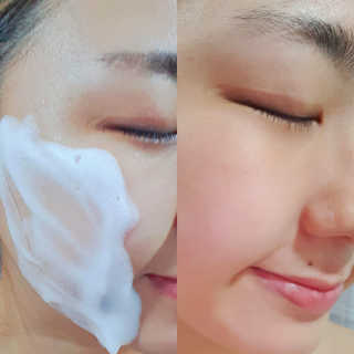 [더메디닥터] 이데베논 클렌징 무스 — 5점을 준 리뷰어가 2019년 7월 올린 사용 사진