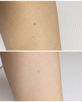 지고트 미네랄 UV 스네일 쿠션 리필포함 — 2점을 준 리뷰어가 2019년 7월 올린 사용 사진