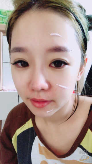 더연 리파이닝 칼라민크림 — 5점을 준 리뷰어가 2017년 11월 올린 사용 사진
