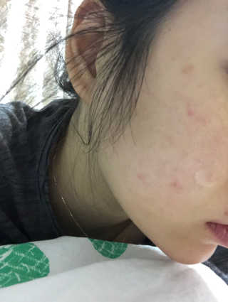 나이팅게일 티타민 크림 리뉴얼 — 4.5점을 준 리뷰어가 2018년 4월 올린 사용 사진