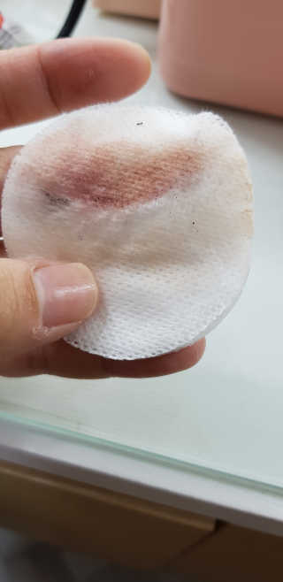 (주)에네스티 그린 티트리 딥 클렌징 워터 300ml — 5점을 준 리뷰어가 2019년 10월 올린 사용 사진