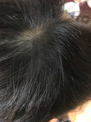 다슈코리아 다슈 안티 헤어로스 헤어쿠션 16g — 4점을 준 리뷰어가 2017년 3월 올린 사용 사진