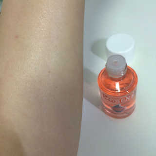 Bio-oil(바이오오일) 바이오오일 — 5점을 준 리뷰어가 2016년 10월 올린 사용 사진
