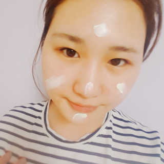 블랙모어스 내츄럴 비타민 E 크림 — 5점을 준 리뷰어가 2018년 2월 올린 사용 사진