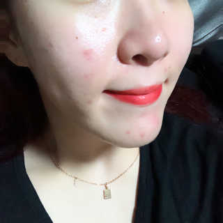 보타니티 [홍]조[진]정[결]케어 플라본 세럼 — 5점을 준 리뷰어가 2018년 5월 올린 사용 사진
