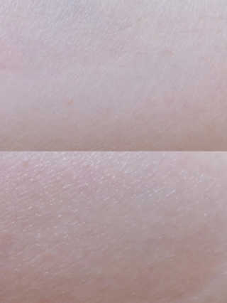 Bio-oil(바이오오일) 바이오오일 — 4.5점을 준 리뷰어가 2016년 10월 올린 사용 사진