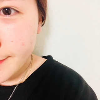 보타니티 [홍]조[진]정[결]케어 플라본 세럼 — 5점을 준 리뷰어가 2018년 5월 올린 사용 사진