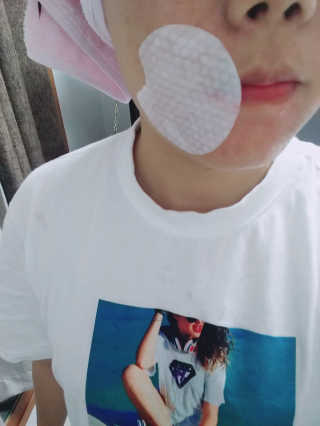 나이팅게일 토닝 필링패드(티트리) — 4.67점을 준 리뷰어가 2017년 10월 올린 사용 사진