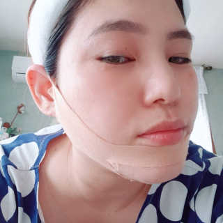 아이디플라코스메틱 아이디 페이스핏 마이너스 밴드 — 3점을 준 리뷰어가 2019년 9월 올린 사용 사진