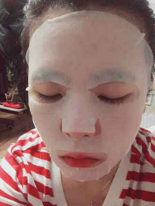 트로피칼뷰티 아쿠아홀릭 코코넛 시트마스크팩 20매 — 4점을 준 리뷰어가 2017년 2월 올린 사용 사진