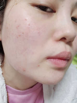 광란쨔응님이 올린 리뷰 사진 2