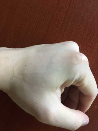 씨엘포 맥스 히아루로닉 프로폴리스 앰플 — 5점을 준 리뷰어가 2019년 1월 올린 사용 사진