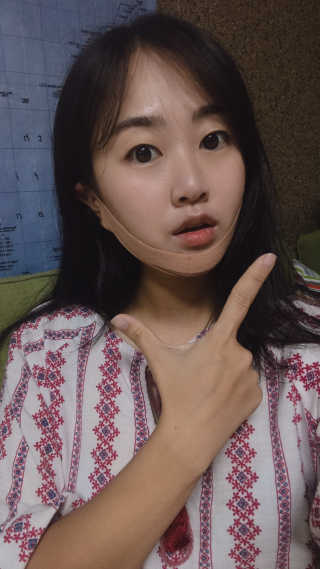 아이디플라코스메틱 아이디 페이스핏 마이너스 밴드 — 5점을 준 리뷰어가 2019년 9월 올린 사용 사진