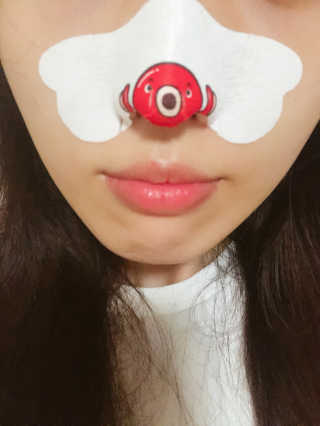 나이팅게일 TAKO PACK NOSE [문어코팩] — 5점을 준 리뷰어가 2018년 7월 올린 사용 사진