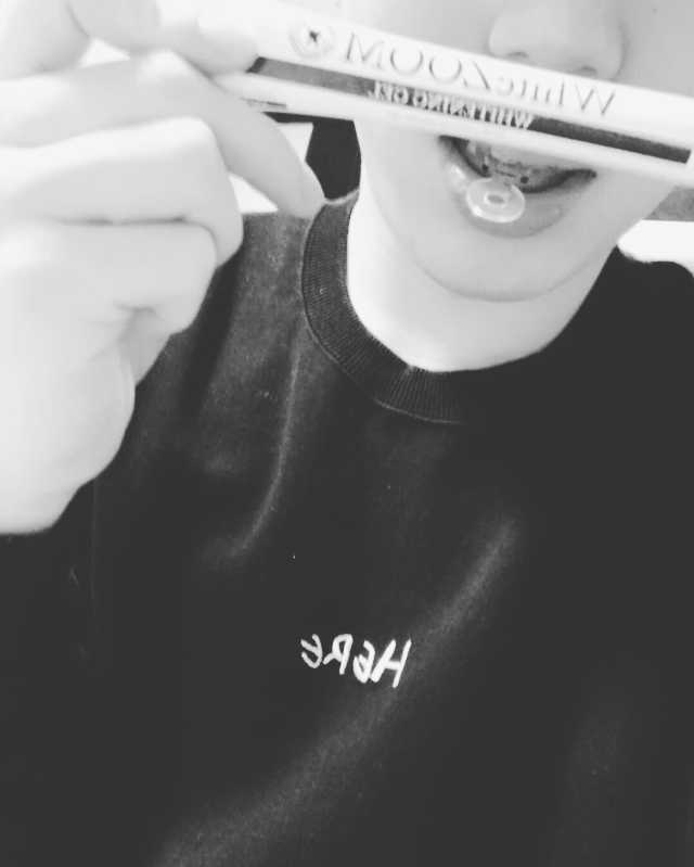 라포랩 화이트줌 치아미백제&개구기 리뷰 사진