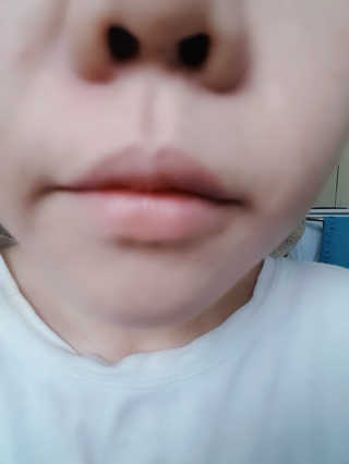 테라다이아 립 메이트 오일 — 4점을 준 리뷰어가 2018년 6월 올린 사용 사진